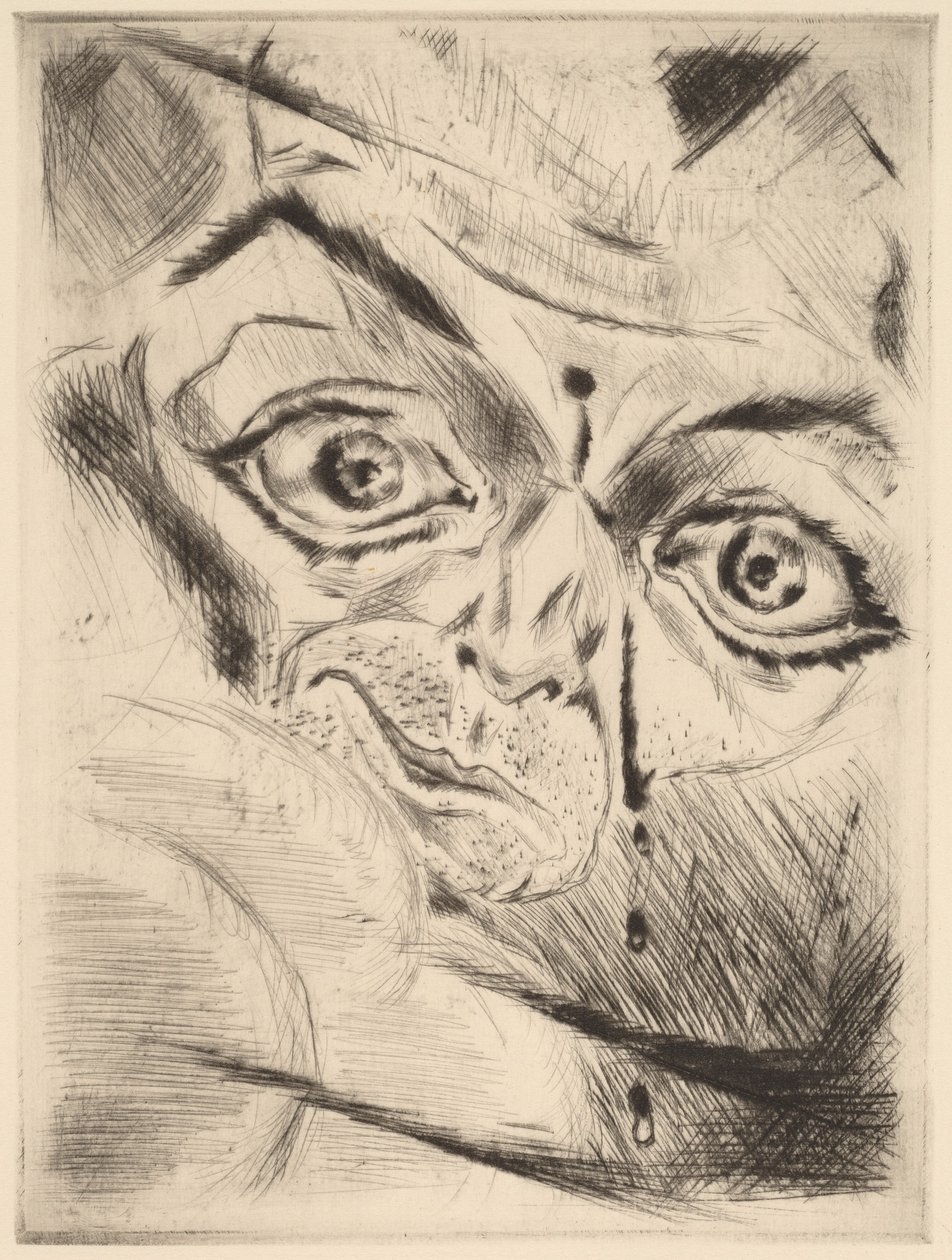 Alnında Kurşun Yarası Olan Peter, 1918. by Walter Gramatte