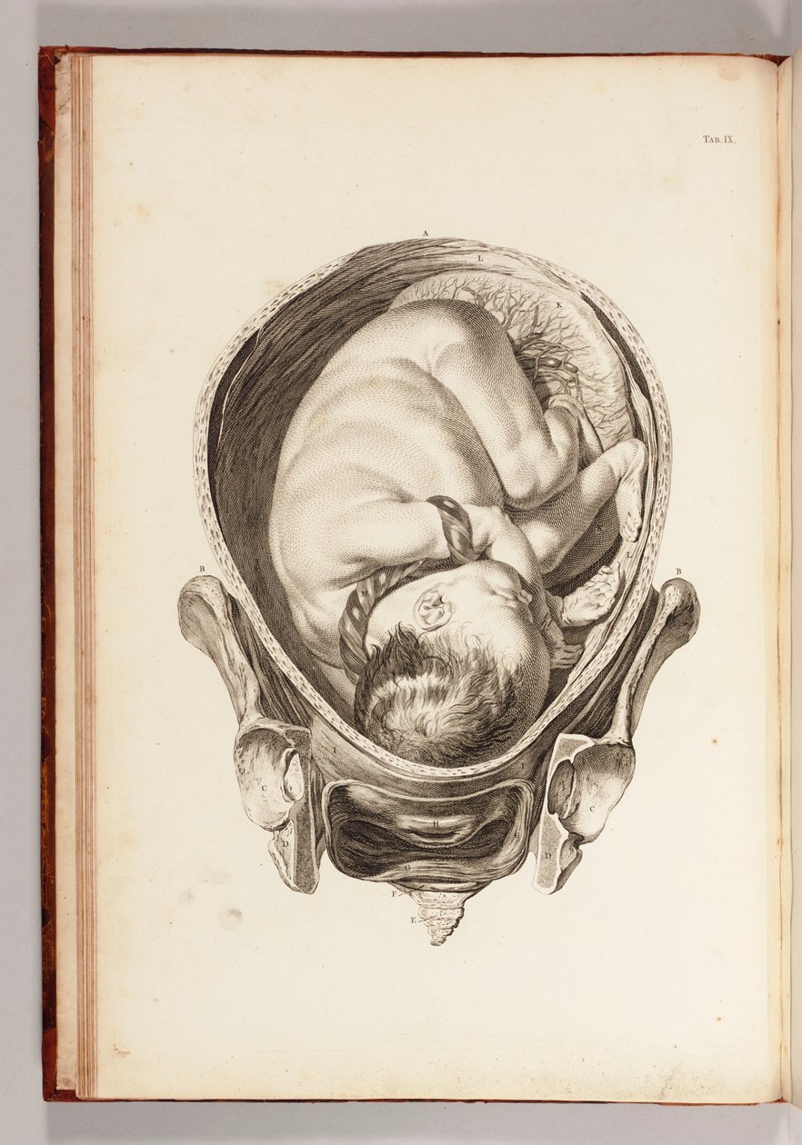 "Ebelik Uygulamasının Açıklamaları ve Bir Kısaltması ile Bir Anatomik Tablolar Seti"nden rahimdeki bir çocuğun gravürü, 1754 by William Smellie