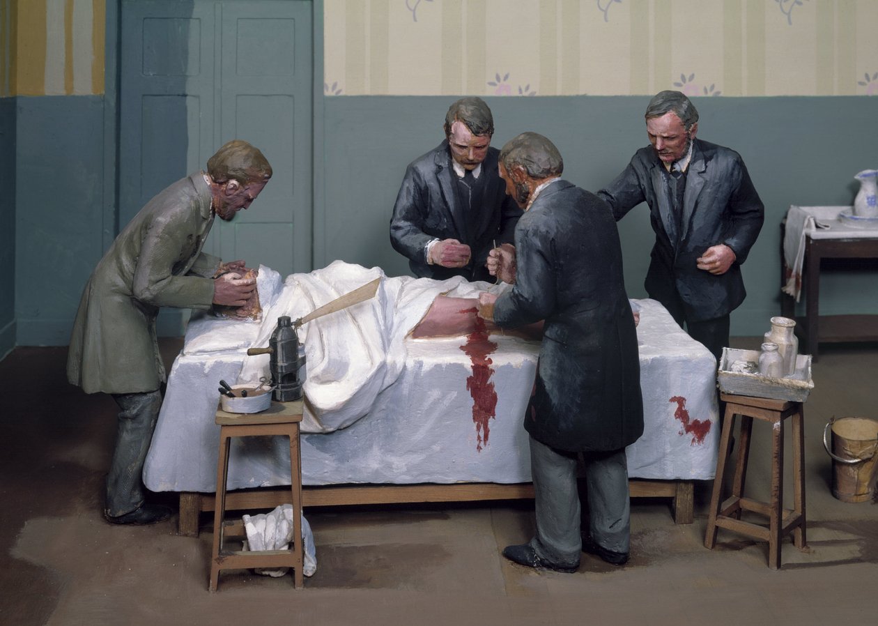 Cerrahi Antiseptikler Antiseptik bir operasyon by Ferdinand Georg Waldmuller