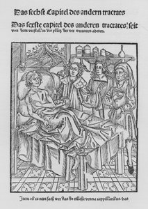 Sirurgia Kitabı, Hieronymus Brunschwig (lito) by (after) German School