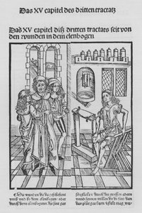 Sirurgia Kitabı, Hieronymus Brunschwig (lito) by (after) German School