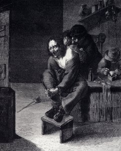 Cerrahi operasyon Adrien Brauwer'in (1608'de yaptı) bir tablosundan sonraki gravür 17. yüzyıl by Adriaen (after) Brouwer
