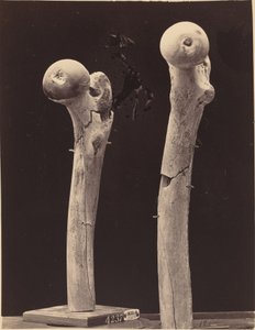 Femur Ateşli Silah Kırıkları Örnekleri by American 19th Century