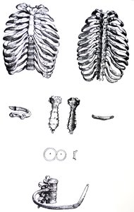 De Humani Corporis Fabrica