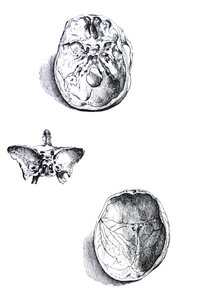 De Humani Corporis Fabrica