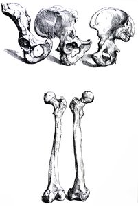 De Humani Corporis Fabrica