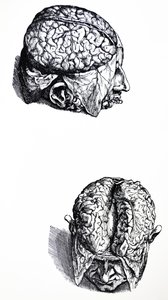 De Humani Corporis Fabrica