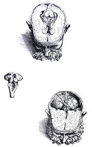 De Humani Corporis Fabrica