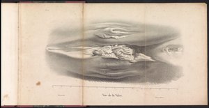 Balinanın Kadın Genitalleri, 1827 Vue de la Vulve (nesne üzerindeki başlık) by Bossuet