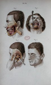 Üst çenenin anatomik plakası by C and Huette E. Bernard
