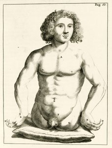 Frederik Dekkers tarafından konjenital doğum kusurları örneği, 1694 by Dutch School