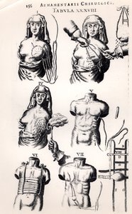 Meme kanseri üzerinde ameliyat, Johannes Schultes (1595-1645) tarafından Amsterdam