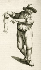 Frederik Dekkers tarafından Tıbbi Yöntemlerde Pratik Egzersizlerden püstüllerle ölü derinin çıkarılması, 1694 by Dutch School