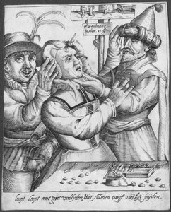 Trepanning, H. Weydmans tarafından oyulmuş (16. yüzyıl) by Dutch School