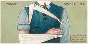 Aksiller Arterin Ped ve Fleksiyon ile Basılması, No.41 Wills