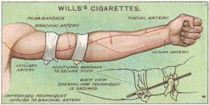 Turnike, No.11 Willss Cigarettes kartlarının İlk Yardım serisinden, 1913 by English School