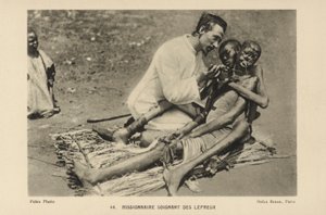 Cüzzamlılarla ilgilenen misyoner by French Photographer