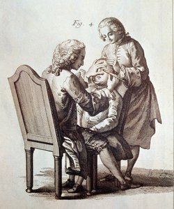 Katarakt hastasını ameliyat eden bir doktor, Denis Diderot ve Jean le Rond d