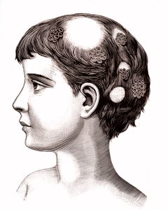 Çocukta saçkıran. 1887 (gravür) by French School