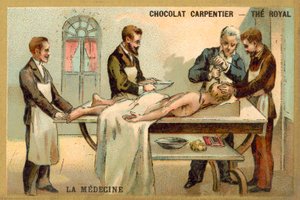 Trepanning (kromolito) by French School