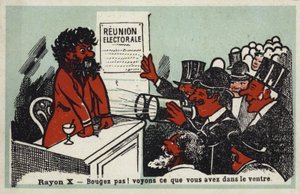 X ışınları - Kımıldama! Bakalım midesinde ne var by French School