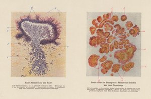 Actinomyces bovis (renkli lito) by German School