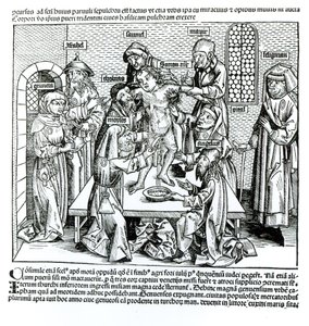 Sünnet, Hartmann Schedel (1440-1514) tarafından yazılan 
