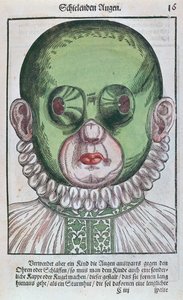 Şaşılık tedavisi için maske, Georg Bartisch (1535-1636) tarafından Dresden