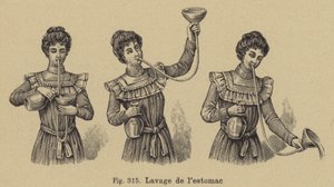Mideyi yıkamak by German School