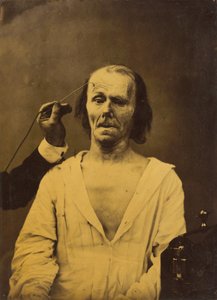 Rahat bir yüz (solda); Derin dikkat (sağda) by Guillaume Benjamin Amant Duchenne