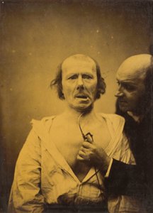 Bu daralma m. platisma tek başına ifadeden yoksundur by Guillaume Benjamin Amant Duchenne