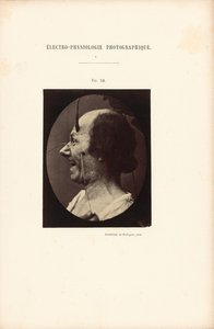  by Guillaume Benjamin Duchenne