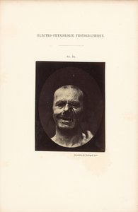  by Guillaume Benjamin Duchenne