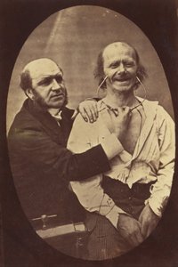 İnsan Fizyonomisinin Mekanizması veya Tutkuların İfadesinin Elektro-Fizyolojik Analizi by Guillaume Benjamin Duchenne