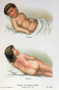 Kızamık ve kızıl, bir aile tıp kitabından, c.1900 by Hungarian School