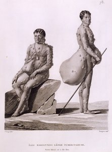 Kuzey Mariana Adaları: Bourgeois tarafından kazınmış 'Voyage Autour du Monde sur les Corvettes de L'Uranie 1817-20'den Tüberkülozdan Acı Çeken İki Adam, 1825 yayınlandı