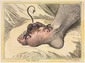 Gut, 1799. by James Gillray