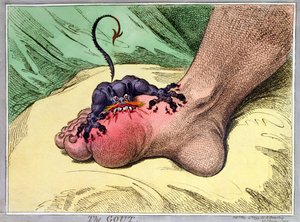 1799 ರಲ್ಲಿ ಹನ್ನಾ ಹಂಫ್ರೆ ಪ್ರಕಟಿಸಿದ ಗೌಟ್ (ಕೈ-ಬಣ್ಣದ ಮೃದುವಾದ ನೆಲದ ಎಚ್ಚಣೆ) ಟರ್ಕ್