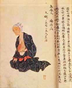 1804 yılında Seishu Hanaoka (1760-1836) tarafından genel anestezi altında gerçekleştirilen meme kanserinin ilk cerrahi tedavisi by Japanese School
