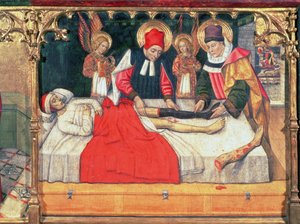 126-0035321 SS. Cosmas ve Damian, Etiyopyalı bir adamın bacağını diyakoz Justinian