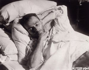 Egon Schiele ölüm döşeğinde, 1918. by Martha Fein
