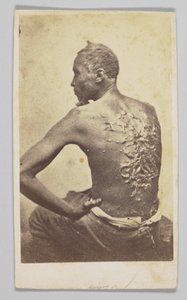 Gordon Tıbbi Muayene Altında, 1863. by McPherson and Oliver