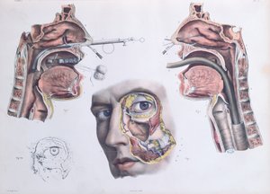 Bir Burun Ameliyatı, Jean-Baptiste Marc Bourgery (1797-1849) 1866-67'nin 'Traite Complet de l'Anatomie de l'Homme'dan bir levha by Nicolas Henri Jacob