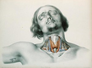 Jean-Baptiste-Leon Dubreuil