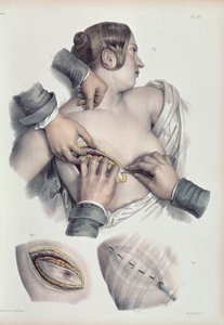 Jean-Baptiste Marc Bourgery (1797-1849) 1866-67
