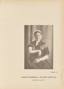 Serebral Atrofi: Parsiyel Epilepsi Sağ Hemipleji by Paul Marie Léon Regnard