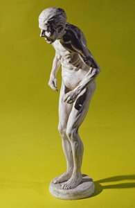 Parkinson Hastalığı olan bir kadın figürü (alçı) by Paul Marie Louis Pierre Richer