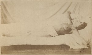 Histerik epilepsi, saldırı, çarmıha germe, Bourneville ve P. Regnard, Paris, 1876