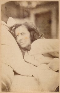 Histerik epilepsi, deliryum, şehvet, levha XXXVI, Bourneville ve P. Regnard, Paris, 1876 (albüm baskısı) 