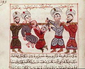 Tıp: ortopedik müdahale. “La Surgery Imperiale”den sonra Charaf-ed-din (Charaf ed Din) (1404-1468) tarafından Türk tıbbının sağımından alınan minyatür (Ms Sup Turk 693 fol. 193) 1466 Paris, B.N. by Persian School